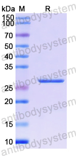 Recombinant Human DNAJA1 Protein, N-His