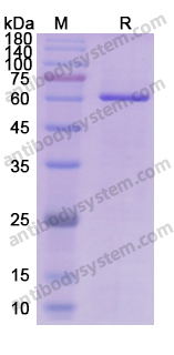 Recombinant Human AKT1 Protein, N-His