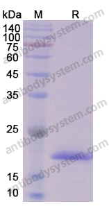 Recombinant Human AKT2 Protein, N-His