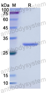 Recombinant Human CASP14 Protein, N-His