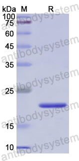 Recombinant Human STIP1 Protein, N-His