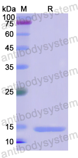 Recombinant Human S100A11 Protein, N-His