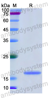 Recombinant Human CD171/L1CAM Protein, N-His