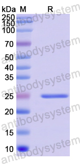 Recombinant Human CD171/L1CAM Protein, N-His