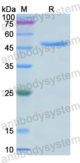 Recombinant Human ARRB2 Protein, C-His