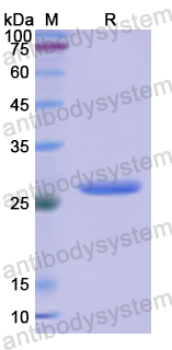 Recombinant Human CD191/CCR1 Protein, N-GST