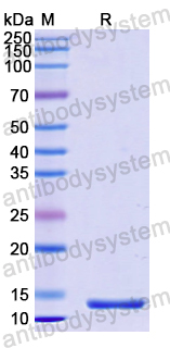 Recombinant Human CD191/CCR1 Protein, N-His