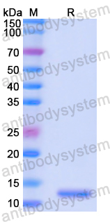 Recombinant Human CD197/CCR7 Protein, N-His