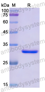 Recombinant Human GRK4 Protein, N-His