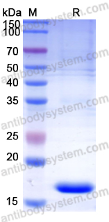 Recombinant Human CDA Protein, N-His