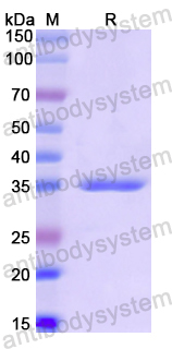 Recombinant Human PYCR1 Protein, N-His