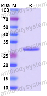 Recombinant Human GTF2H1 Protein, N-His