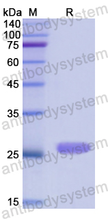 Recombinant Human CTH Protein, N-His