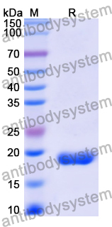 Recombinant Human CD70 Protein, N-His