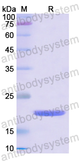 Recombinant Human CD153/TNFSF8 Protein, N-His