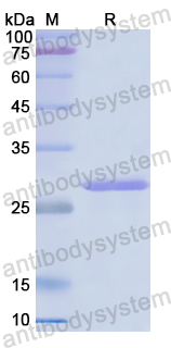 Recombinant Human ACSL1 Protein, N-His