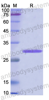 Recombinant Human CD144/CDH5 Protein, N-His