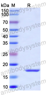 Recombinant Human DUT Protein, N-His