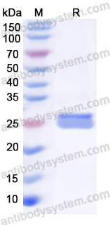 Recombinant Human GUCY1A2 Protein, N-His