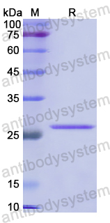 Recombinant Human CD80/B7-1 Protein, N-His