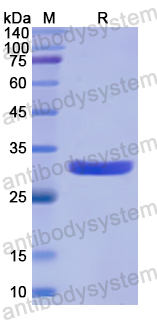 Recombinant Human TTK Protein, N-His