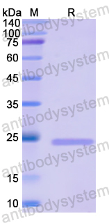 Recombinant Human MCM5 Protein, N-His