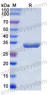 Recombinant Human CD68 Protein, N-His