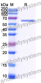Recombinant Human SHMT1 Protein, N-His-SUMO