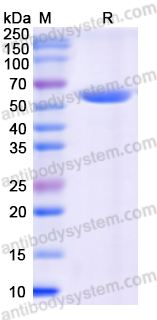 Recombinant Human SHMT2 Protein, N-His