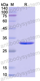 Recombinant Human RYK Protein, N-His