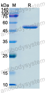 Recombinant Human MPI Protein, N-His