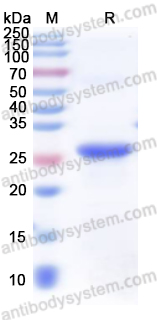 Recombinant Human CRHR1 Protein, N-His-SUMO
