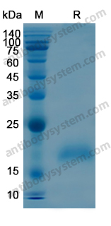 Recombinant Human BTC Protein, N-His