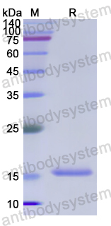 Recombinant Human PFN2 Protein, N-His