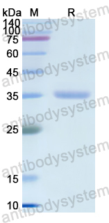 Recombinant Human CA8 Protein, N-His