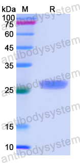 Recombinant Human CTNNA1 Protein, N-His