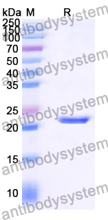 Recombinant Human CTNNA1 Protein, N-His