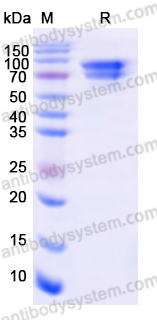 Recombinant Human CTNNB1 Protein, N-His