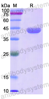 Recombinant Human SERPINB6 Protein, N-His