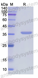 Recombinant Human RDX Protein, N-His