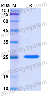 Recombinant Human RCVRN Protein, N-His