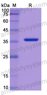 Recombinant Human SFTPD Protein, N-His