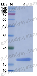 Recombinant Human ADRA1A Protein, N-His