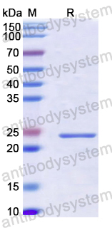 Recombinant Human HRH1 Protein, C-His
