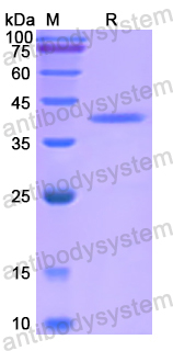 Recombinant Human RORA Protein, N-His-SUMO