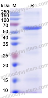 Recombinant Human THBS4 Protein, N-GST