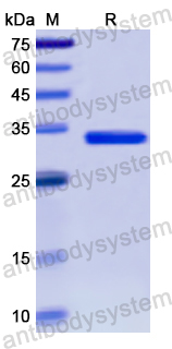 Recombinant Human IDUA Protein, N-His