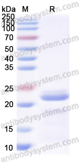 Recombinant Human KRT9 Protein, N-His