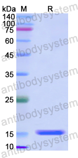 Recombinant Human Asprosin Protein, N-His