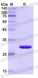 Recombinant Human PCK1 Protein, N-His